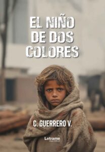 El niño de dos colores